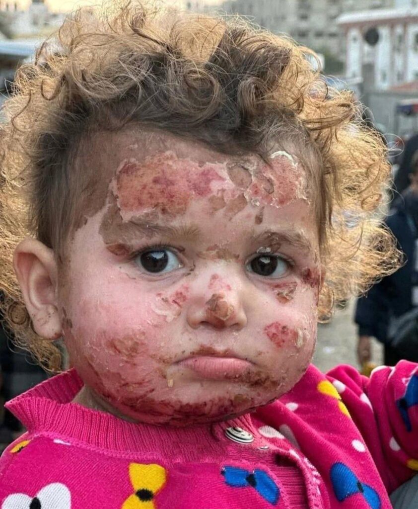 Gazze’de katliamlar devam ediyor!